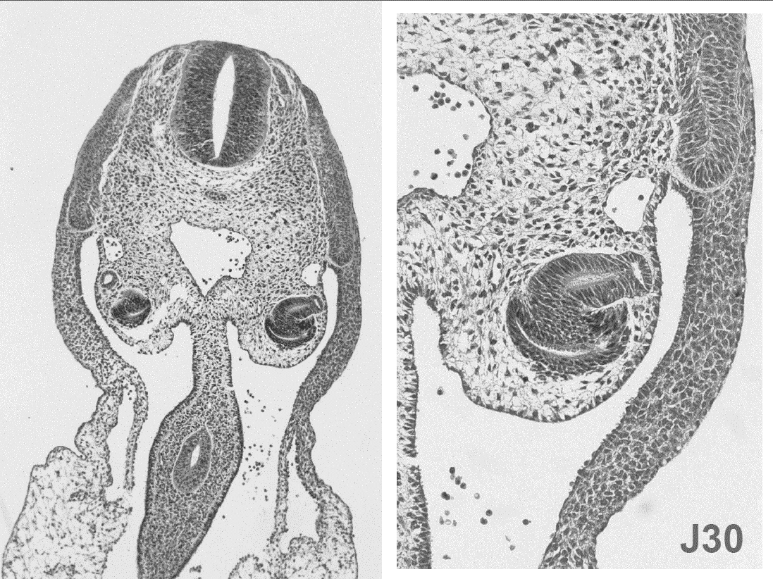 Tube neural Aorte dorsale Mésoblaste intermédiaire Vésicule rénale Corps en S Mésoblaste dorsal Cavité péritonéale Intestin primitif L aorte dorsale contient des hématies embryonnaires soit nuclées