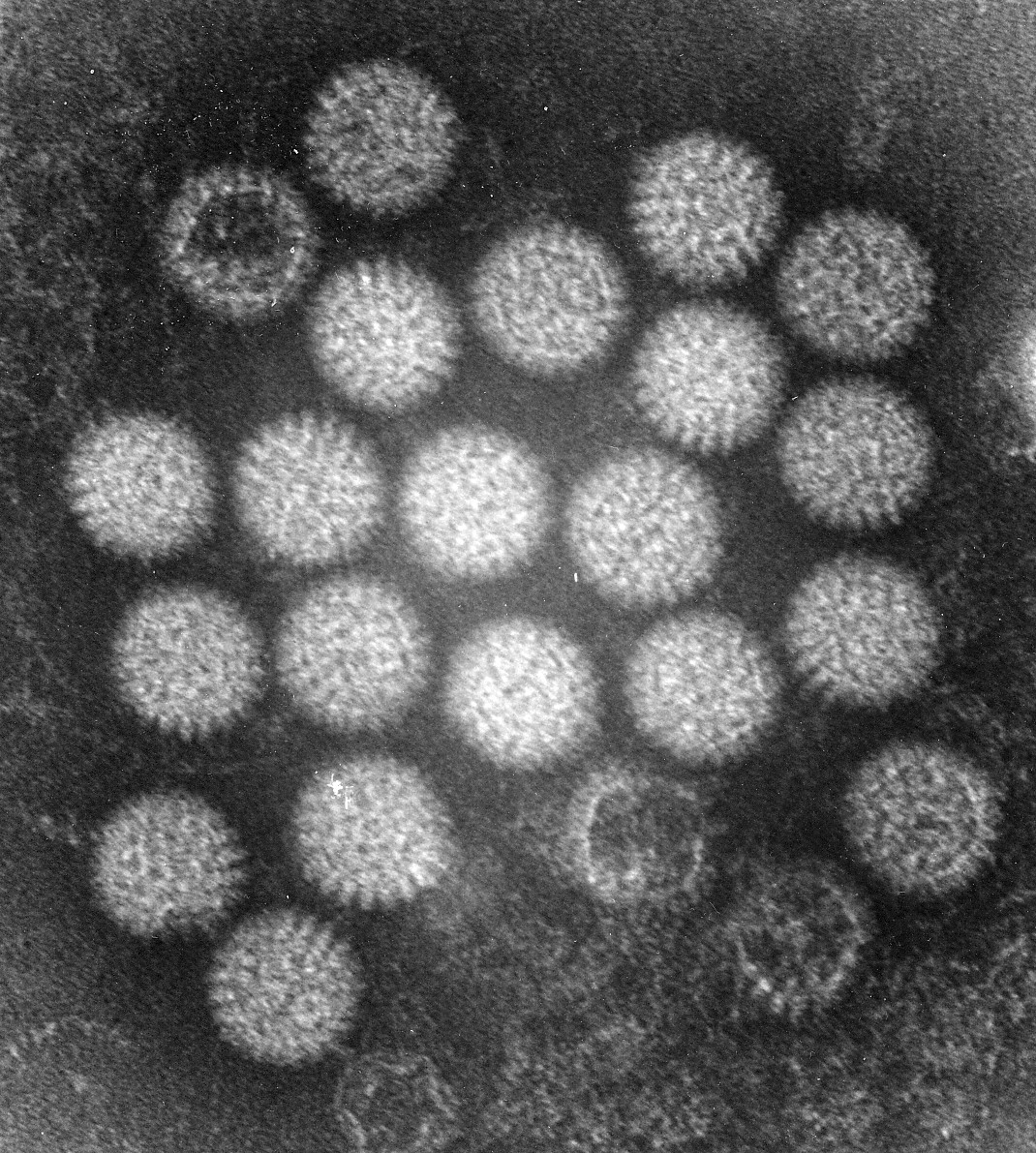 Les Rotavirus Morphologie Virus non enveloppés. Diamètre : 70 nm. Capside : icosaédrique en forme de roue (d où son nom «rota»), caractéristique en microscopie électronique.