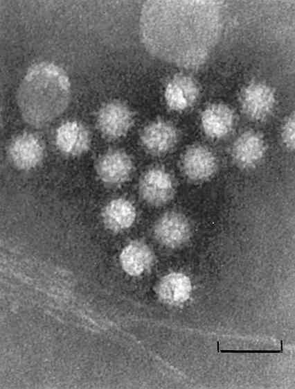 Les Calicivirus Morphologie Virus non enveloppés.
