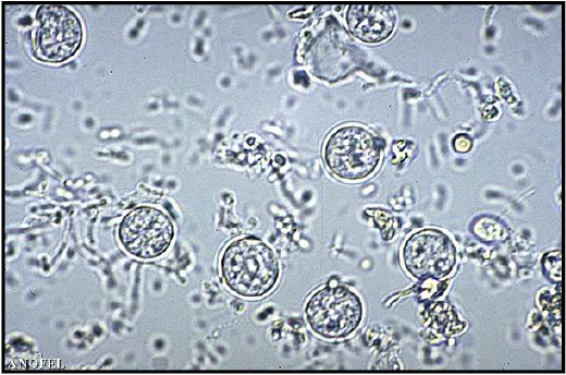 G. Cyclospora cayetanensis C est encore une coccidi, qui est proche de Toxoplasma.