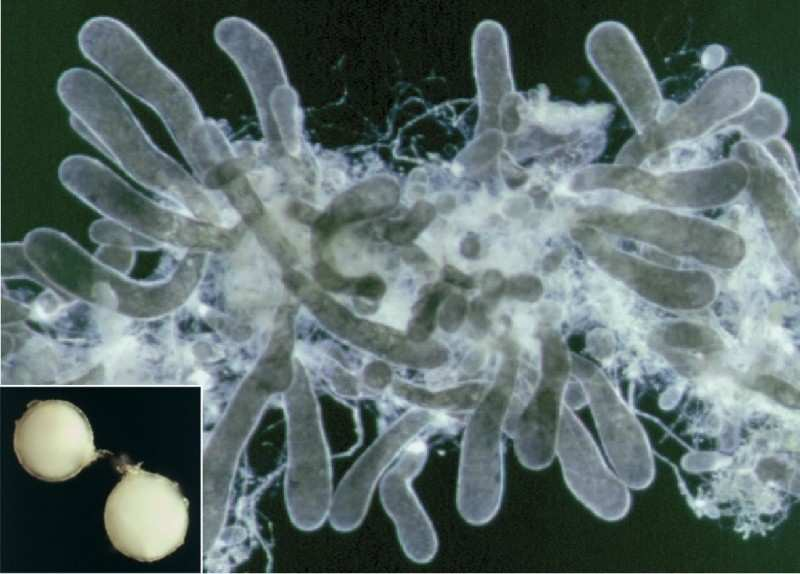 Geosiphon pyriformis : champignon coenocytique (1