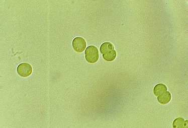 Cyanobactéries Diversité