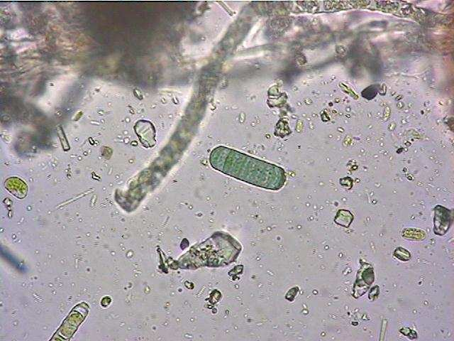 Cyanobactéries Reproduction Hormogonies: Fragments de filaments dans les colonies filamenteuses accumulent de