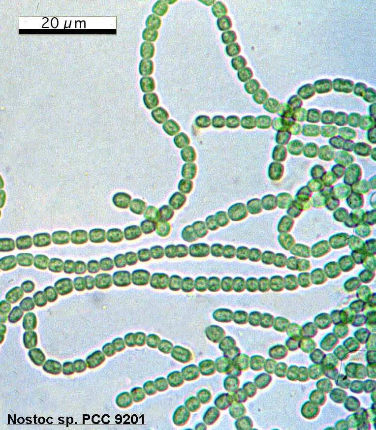 Cyanobactéries Diversité morphologique Structure coloniale filamenteuse Filaments de alignées (trichomes)
