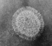 Virus récemment r identifiés Métapneumovirus humain (hmpv) Identifié en 2001 Génétiquement proche du VRS 2ème cause de bronchiolites chez l enfant Tableaux cliniques # VRS Prévalence