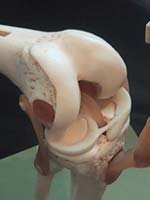 Le ligament croisé antérieur du Genou Anatomie : Le ligament croisé antérieur (LCA) est situé au milieu du genou (il fait partie du "pivot central").
