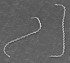 LEPTOSPIRES AU MICROSCOPE ÉLECTRONIQUE Bactéries spiralées mobiles (spirochètes)