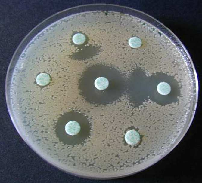 Antibiogramme Mise en évidence de la présence d une Bêtalactamase à spectre étendu (BLSE) chez la bactérie étudiée,