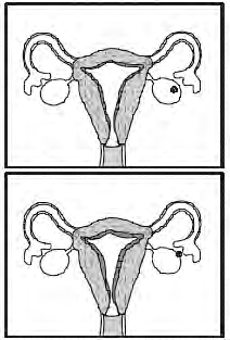 grossss). Libération d'un ovul mûr (ovulation).