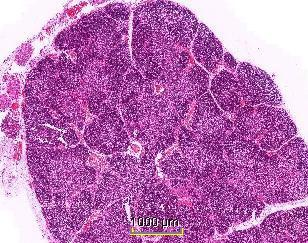 involution Thymique et perte de l aspect lobulé Le tissu lymphoïde