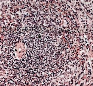 Tissu lymphoïde Pulpe blanche : GLPA (T) + corpuscules de Malpighi (B) Zone marginale Tissu lymphoïde lâche Nombreux sinus vasculaires autour des follicules lymphoïdes