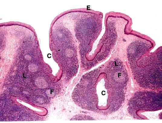Amygdales linguales 1/3 postérieur de la langue