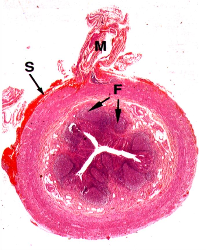 Appendice Diverticule cylindrique : 5 à 10 cm long x 1 cm diamètre Face postéro-interne du cæcum, sous l iléon Lumière étroite et tortueuse
