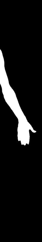 La polyarthrite rhumatoïde La polyarthrite rhumatoïde s attaque aux petites articulations des doigts et des orteils, mais elle épargne généralement celles situées le plus près des ongles.