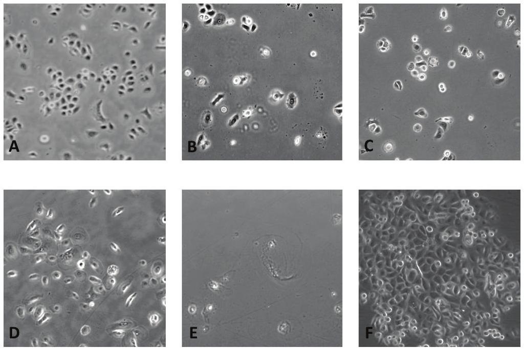Figure 12. Images des lignées cellulaires A : Image de la lignée cellulaire primaire HEKn. B : Image de lignée cellulaire HEKn htert post-sélection à l hygromycine.
