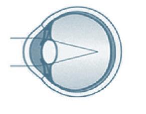 L iris, partie colorée de l oeil, s agrandit ou se contracte afin de contrôler l entrée de la lumière.