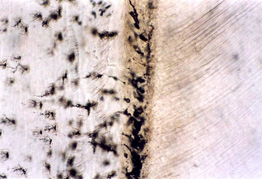 La couche granulaire de Tomes Jonction dentinocémentaire sèche,, x 200)