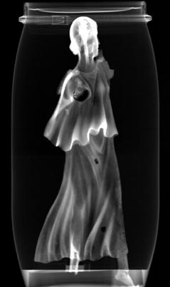 Figure 4 ~ Pièce quadrangulaire soudée sur la Victoire, au-dessus de l épaule droite, vue depuis le revers (patte de fixation sur le support?) et canal d alimentation en métal de la tête.