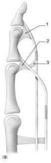 phénomène de corde a arc) Nutrition des tendons fléchisseurs : Vascularisation directe : extrémités, vincula Pompe