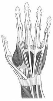 Lésions traumatiques des tendons extenseurs Relativement fréquentes, les lésions des tendons extenseurs ont la fausse réputation de ne poser guère de problèmes par rapport aux lésions des tendons