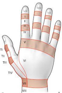 La cicatrisation des tendons extenseurs est habituellement facilement obtenue mais la hantise doit être une raideur séquellaire, le plus souvent en extension Considérations anatomophysiologiques :