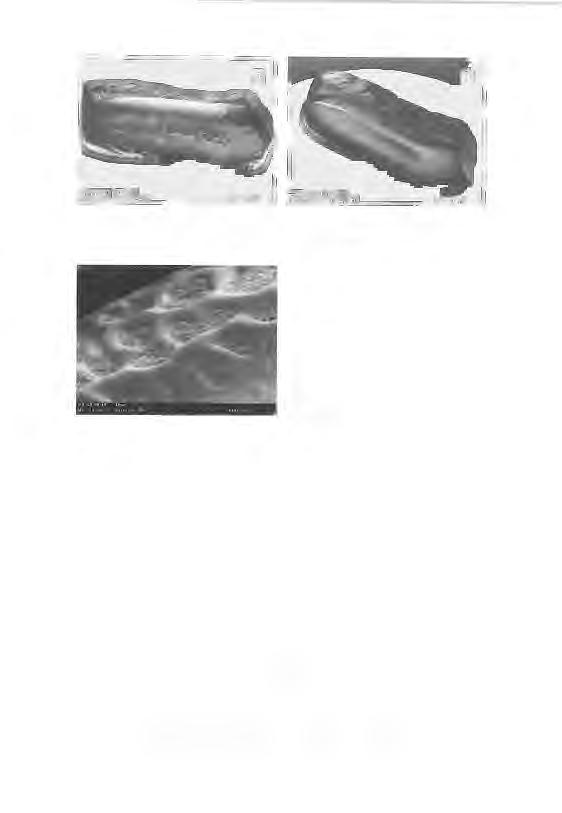 Fig. 23 : M014: a: "occlusal" view, b: lateral oblique: Palaeobates angustissimus. Lmd: 4.8 mm. Fig.