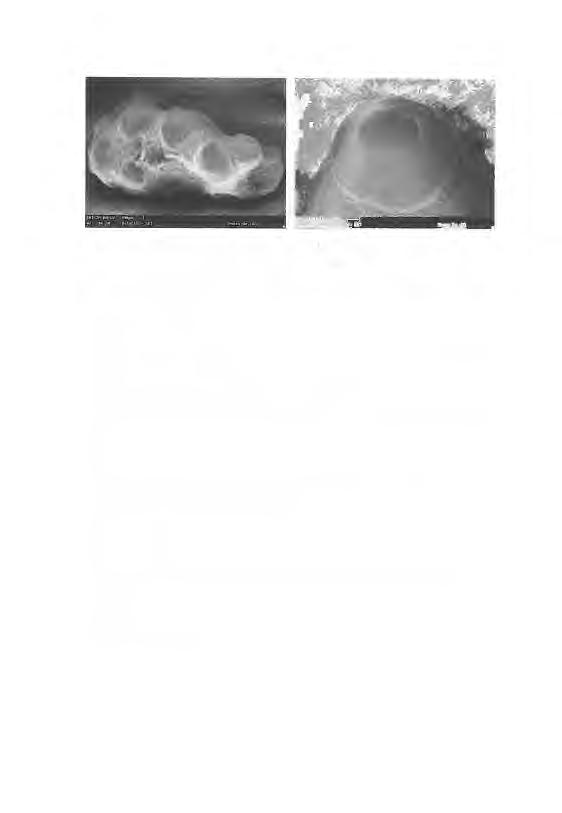 Fig. 41: MT3as or MT4d: M0126A; M0126B (detail): coronoid or palatine teeth of Semionotiform?