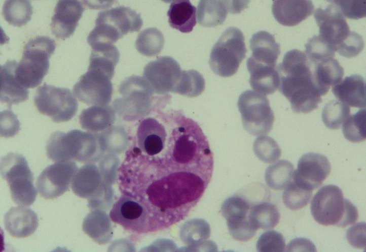 érhytroblastes Gamétocytes de P