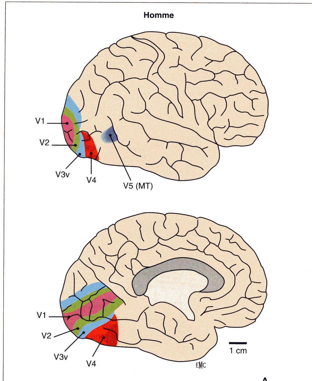 reconnaissance, verbalisation, mémoire Toute lésion peut entraîner un déficit campimétrique et des tr neuro visuels what Aires visuelles where Traitement de l information visuelle Au-delà de V1 par