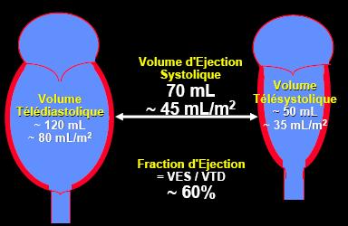 Courbe rose pale: pression artérielle (donc aortique comme on est à gauche) Courbe verte: pression de l'og. Courbe jaune: pression du VG.