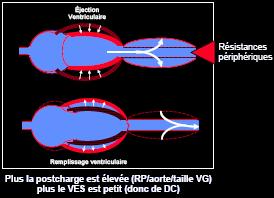 VI. Éjection ventriculaire et postcharge <-LA diapo à retenir pour la postcharge! Loi de Laplace (lien avec un certain arrêt de RER?
