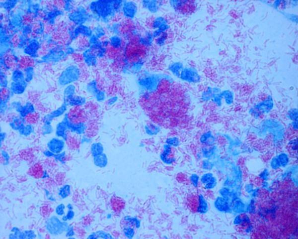 Colorations. simple : bleu de methylene forme des bacteries, organisation  diagnostique infection a gonocoques - PDF Free Download