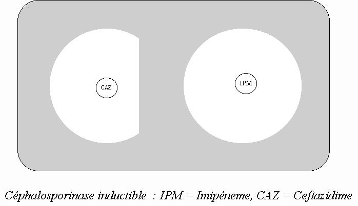 resistante/intermediaire/sensible a l'antibiotique analyse de l'action addictive / inactive de deux antibiotiques en fonction de l'angle ou se recoupent les cercles d'inhibition