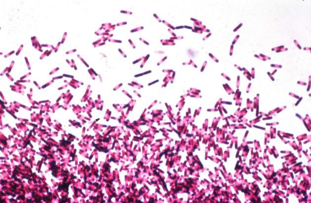 zettnov flagelles, cils bacteriens et corps noirs La coloration Neisser( Neisser(