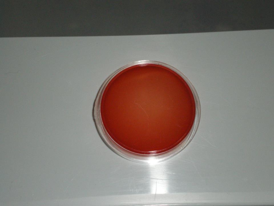 (autour colonies) staphylocoque doré hemolyse