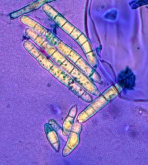 Agent pathogène La maladie des taches brunes du manioc est provoquée par un champignon : Cercosporidium henningsii. Plantes hôtes Le Champignon C.