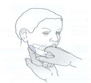 médiale de la glande, Chemine sur la face latérale du muscle hyoglosse, Puis il passe entre la glande sublinguale