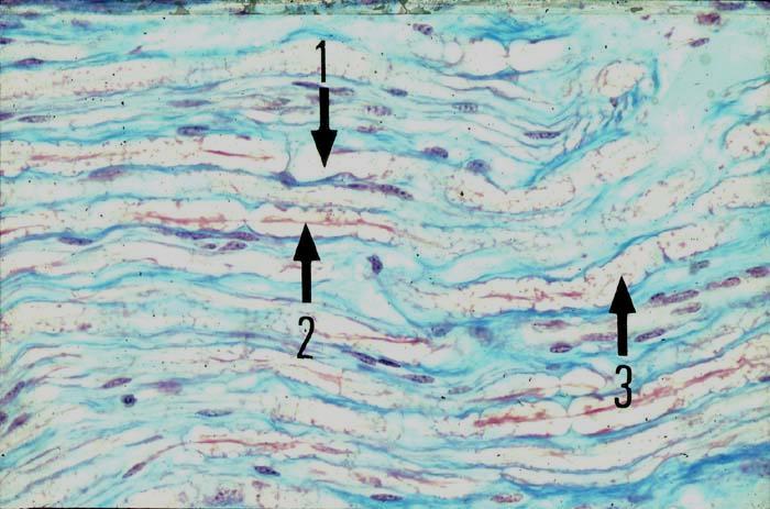 Détaillons les fibres nerveuses myélinisées. En 1, la gaine de myéline est un manchon formé de l'accolement de membranes schwanniennes. Elle entoure l axone fléché en 2.