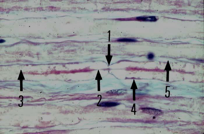 La gaine de myéline n'est pas continue. Elle est régulièrement interrompue au niveau de contact de deux cellules de Schwann en 1.