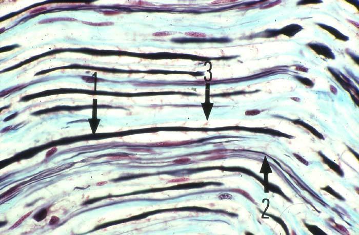 Une imprégnation argentique met en évidence les axones. En 1, est fléché l axone d'une fibre myélinisée.
