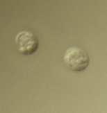 Microscopie à contraste interférentielle 1000X Oocystes de Cryptosporidium Survivent dans les eaux froides (4 C) jusqu à 18 mois Résistent à divers stress