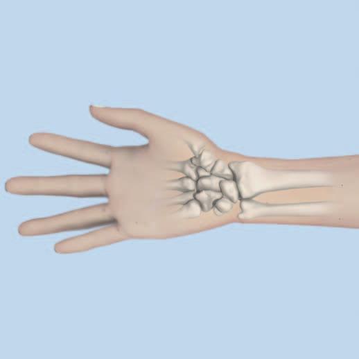 Abord Pratiquer une incision longitudinale légèrement radiale par rapport au tendon du grand palmaire.