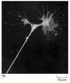 Le cône de croissance des nerfs pousse et explore l'environnement de la cellule nerveuse pour établir