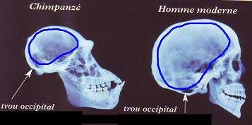 - L Humain a un cerveau plus développé que celui du chimpanzé. 5 Ci après des radiographies du crâne à la même échelle. En bleu le tracé du cerveau.