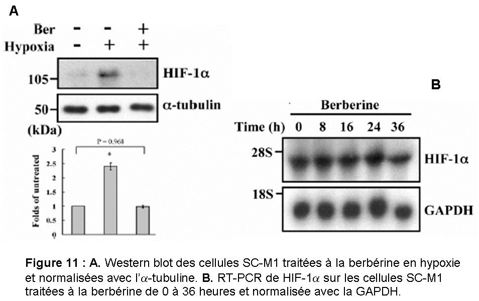 Rétablissement de l acétylation de HIF-1α Le western blot de l immunoprécipitation des protéines
