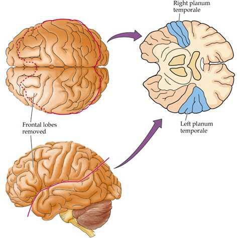 Cortex cérébral (chap.