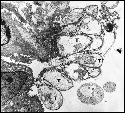 kyste mature de Pneumocystis ( C ) contenant 6 sporozoïtes