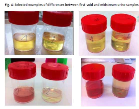 Quelle fraction de l urine? Vorsters A al, 2014, Eur J Clin Microbiol Infect Dis Quelle fraction de l urine?