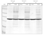 échantillons (déplétion albumin ) Comparaison des gels 2D correspondants à différentes phases de jeûne Séparation sur gel 2D Excision Digestion F. Dantzer et V.