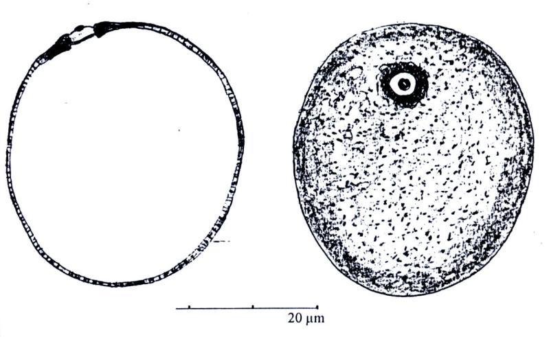- Grains monoporés, sphéroïdale à ovoïde avec une exine mince (28-30